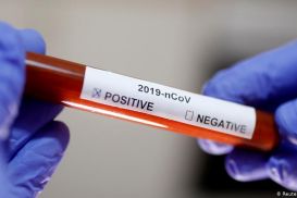 Сколько тестов на выявление коронавируса есть в Казахстане?