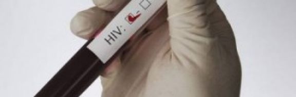 В Казахстане ВИЧ-инфицированный осужденный укусил сотрудника колонии